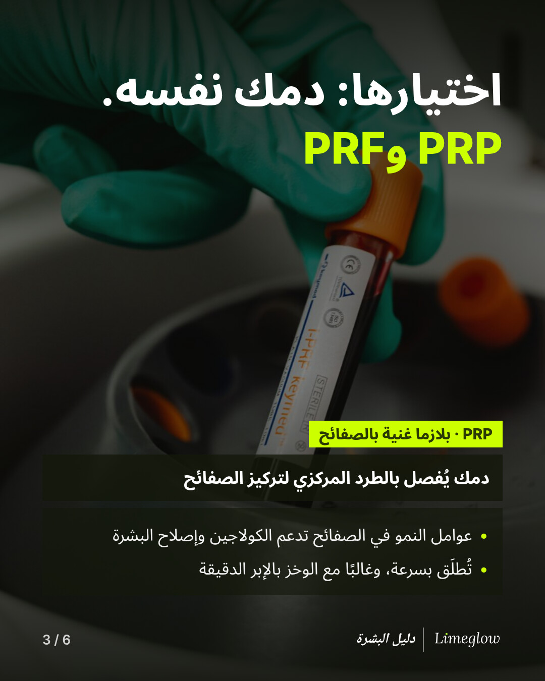 اختيارها هو دمك نفسه: PRP وPRF. البلازما الغنية بالصفائح الدموية (PRP) هي دمك بعد فصله بجهاز الطرد المركزي لتركيز الصفائح الدموية. تدعم عوامل النمو فيها الكولاجين وإصلاح البشرة، وتُطلَق بسرعة، وغالبًا ما تُستخدم مع الوخز بالإبر الدقيقة.