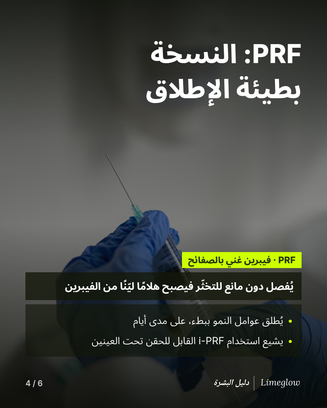 الفيبرين الغني بالصفائح (PRF) يُفصل بالطرد المركزي دون مانع للتخثّر، فيتحوّل إلى هلام ليّن من الفيبرين. ويُطلق عوامل النمو ببطء. ويحظى i-PRF القابل للحقن بشعبية في منطقة تحت العينين.