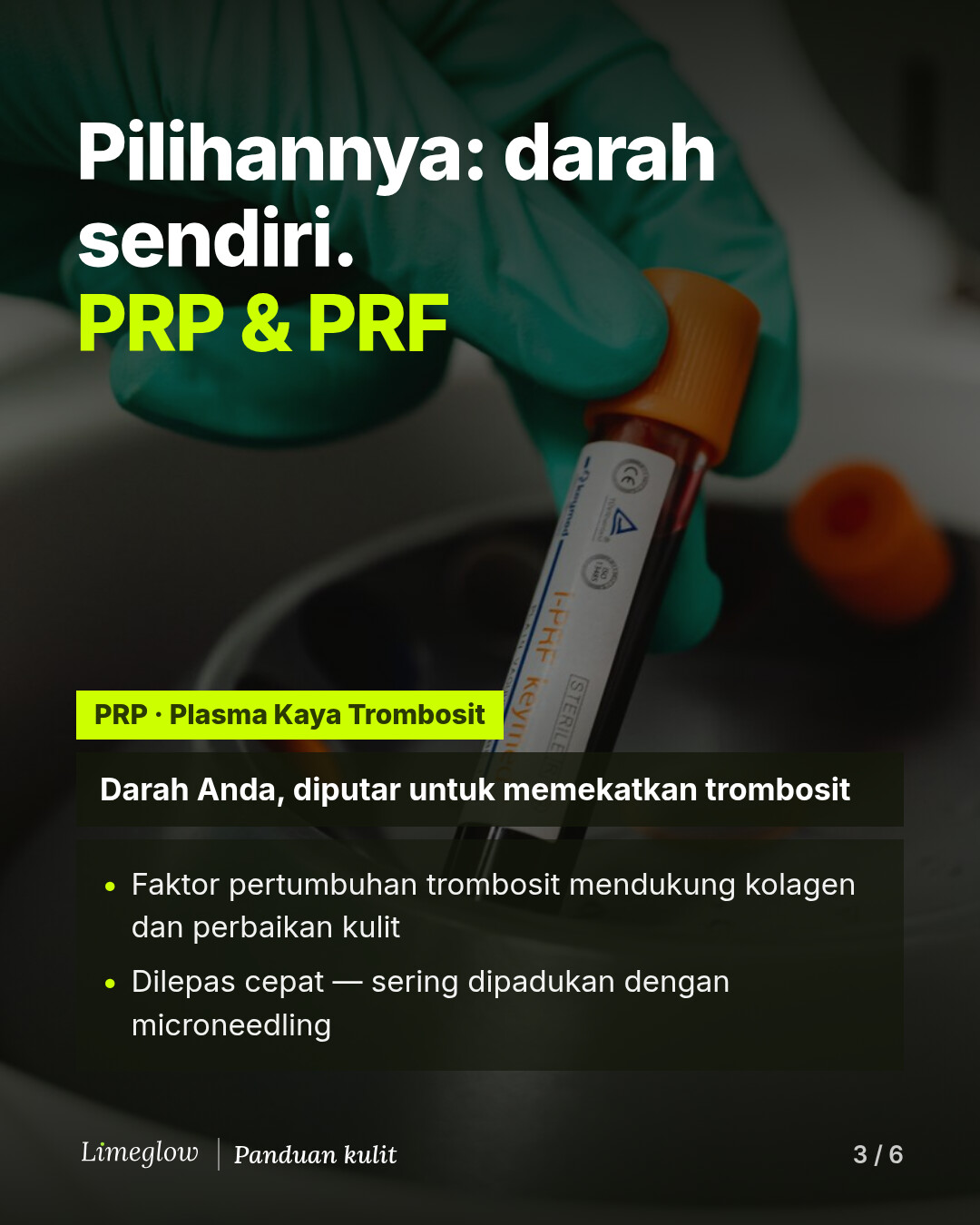 Pilihannya adalah darah Anda sendiri: PRP dan PRF. PRP, plasma kaya trombosit, adalah darah Anda yang diputar untuk memekatkan trombosit. Faktor pertumbuhannya mendukung kolagen dan perbaikan kulit, dilepaskan dengan cepat, sering dipadukan dengan microneedling.