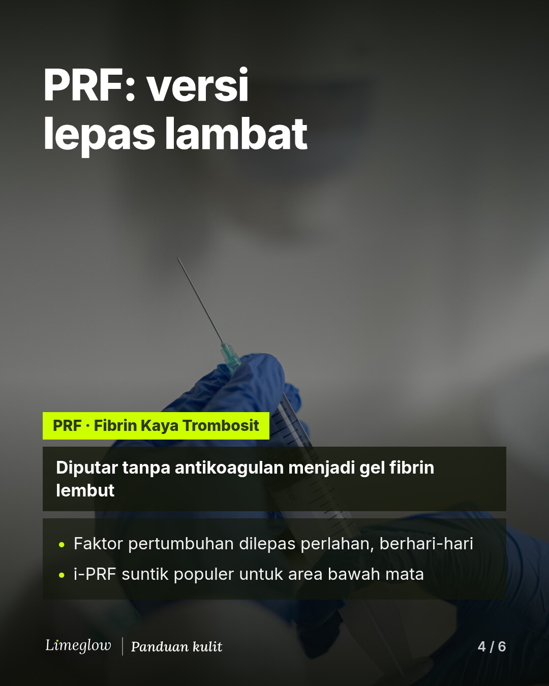 PRF, fibrin kaya trombosit, diputar tanpa antikoagulan hingga menjadi gel fibrin yang lembut. Faktor pertumbuhannya dilepaskan secara perlahan. i-PRF dalam bentuk suntik populer untuk area bawah mata.