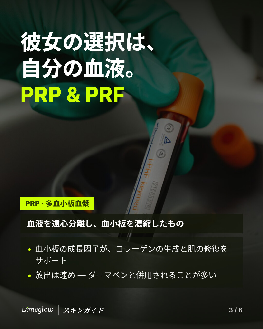 彼女が選んだのは自分の血液から作るPRPとPRF。PRP（多血小板血漿）は、血液を遠心分離して血小板を濃縮したものです。成長因子がコラーゲンの生成と肌の修復をサポートし、すばやく放出されます。マイクロニードリングと併用されることが多い施術です。