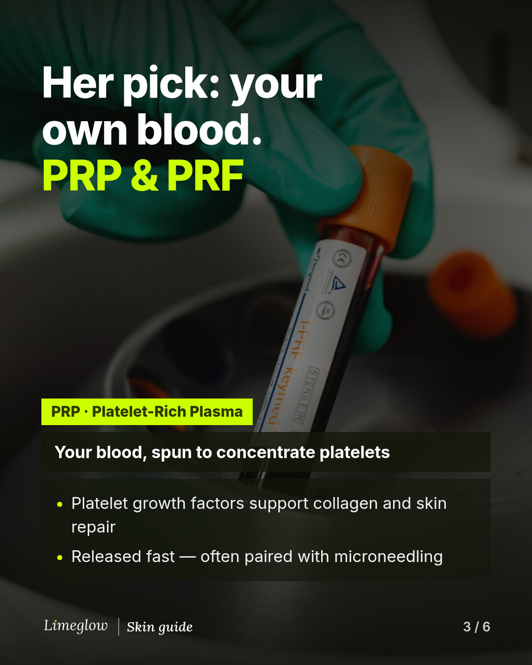 Her pick is your own blood: PRP and PRF. PRP, platelet-rich plasma, is your blood spun to concentrate platelets. Its growth factors support collagen and skin repair, released quickly, often with microneedling.