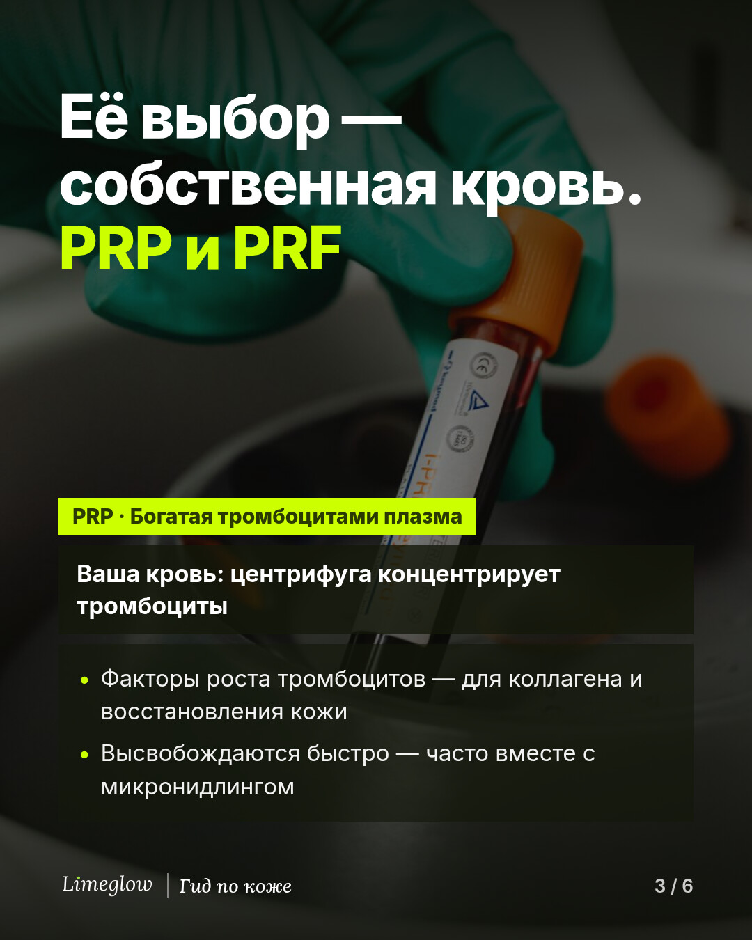 Её выбор — собственная кровь: PRP и PRF. PRP, богатая тромбоцитами плазма, — это ваша кровь, обработанная в центрифуге, чтобы сконцентрировать тромбоциты. Их факторы роста поддерживают выработку коллагена и восстановление кожи и высвобождаются быстро; PRP часто сочетают с микронидлингом.
