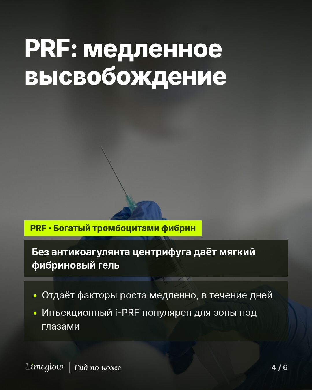 PRF, богатый тромбоцитами фибрин, получают в центрифуге без антикоагулянта — в виде мягкого фибринового геля. Он высвобождает факторы роста медленно. Инъекционный i-PRF популярен для зоны под глазами.