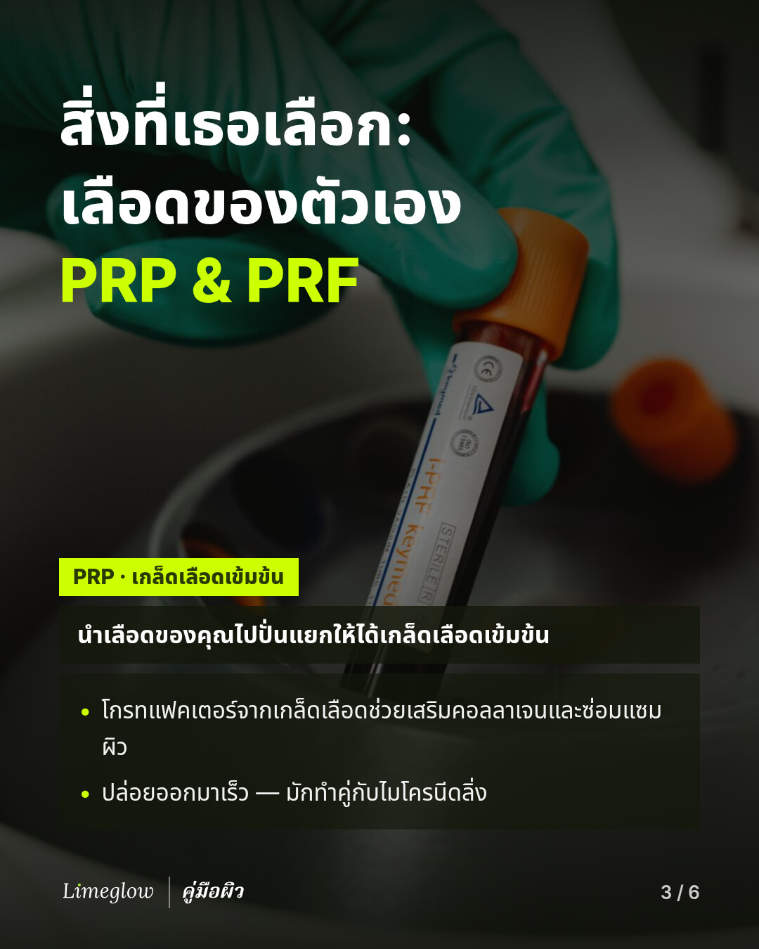 สิ่งที่เธอเลือกคือเลือดของตัวเอง: PRP และ PRF โดย PRP หรือเกล็ดเลือดเข้มข้น คือเลือดของคุณที่นำไปปั่นแยกให้ได้เกล็ดเลือดเข้มข้น โกรทแฟคเตอร์ในเกล็ดเลือดช่วยเสริมคอลลาเจนและการซ่อมแซมผิว โดยปล่อยออกมาอย่างรวดเร็ว และมักทำคู่กับไมโครนีดลิ่ง