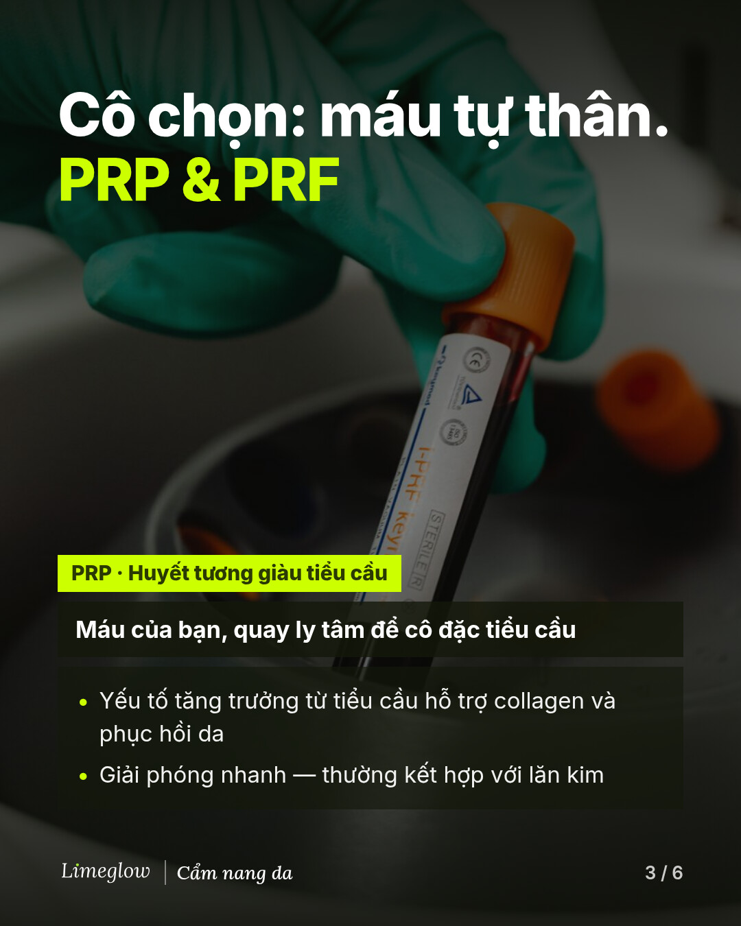 Lựa chọn của cô là máu của chính bạn: PRP và PRF. PRP, huyết tương giàu tiểu cầu, là máu của bạn được quay ly tâm để cô đặc tiểu cầu. Các yếu tố tăng trưởng trong đó hỗ trợ collagen và phục hồi da, được giải phóng nhanh, thường kết hợp với lăn kim.