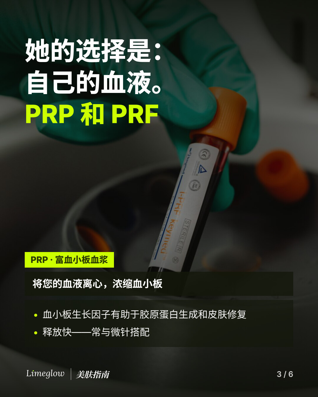 她的选择是自己的血液：PRP 和 PRF。PRP 即富血小板血浆，是将您的血液离心、浓缩血小板制成。其中的生长因子有助于胶原蛋白生成和皮肤修复，释放快，常与微针搭配。