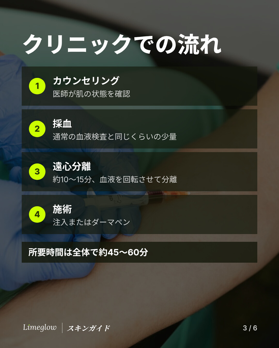 クリニックでの流れ：カウンセリング、少量の採血、10〜15分の遠心分離のあと、注入またはマイクロニードリング。全体で約45〜60分です。