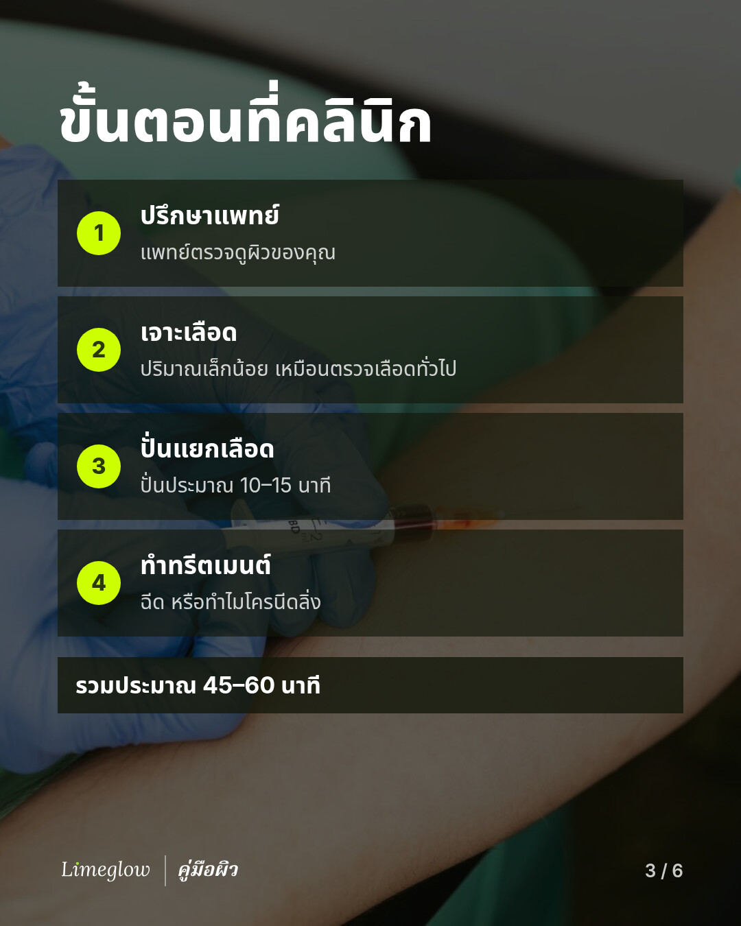 ขั้นตอนที่คลินิก: ปรึกษาแพทย์ เจาะเลือดปริมาณเล็กน้อย ปั่นแยกในเครื่องปั่นเหวี่ยง 10 ถึง 15 นาที จากนั้นฉีดหรือทำไมโครนีดลิ่ง รวมประมาณ 45 ถึง 60 นาที
