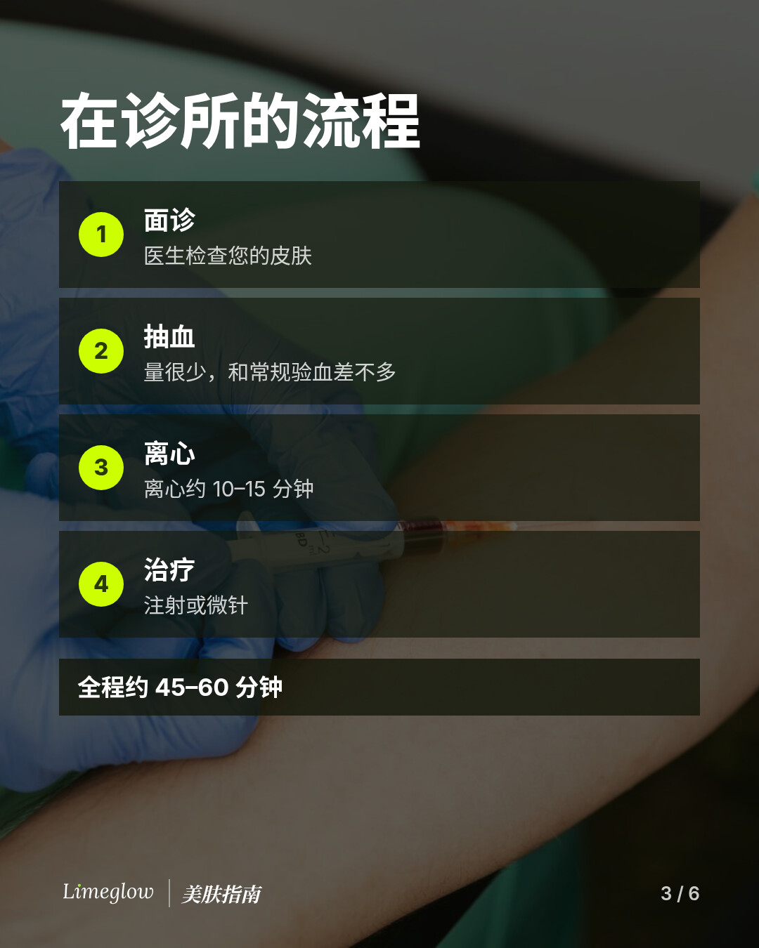 在诊所：面诊，少量抽血，离心 10 至 15 分钟，然后进行注射或微针。全程约 45 至 60 分钟。