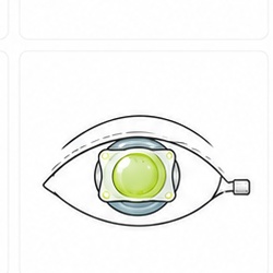 ICL treatment at Eyereum Eye Clinic Seoul Korea