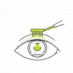 LASEK treatment at Eyereum Eye Clinic Seoul Korea